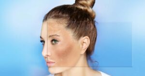 Avis et test de l'autobronzant phytobronz