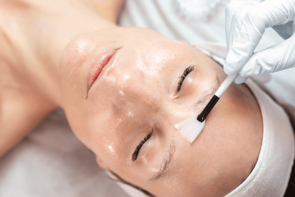 avant apres peeling retinol